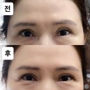 (유)효명 | 등촌역 속눈썹펌 잘하는 곳｜라라뷰래쉬 속눈썹펌 솔직후기