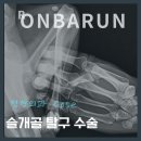 베이동물병원 | [온바른 케이스] 슬개골탈구 수술 케이스 [경기광주동물병원][24시온바른동물의료센터]