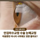 김해밝은안과의원 이미지