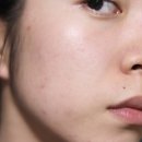 법대로 | 이옴 트러블 패치 마스크 후기 사용법대로 하니까 대박