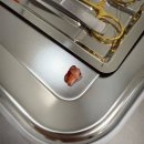 (주)선소프트 | 서울 썬프라자치과 내돈내산 매복사랑니발치 투명교정 시스루얼라이너 턱관절치료 소프트 하드타입 차이