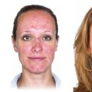 필바이오 이미지