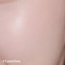 연세라미슈의원 | 스킨보톡스 후 효과 만족한 리얼 후기