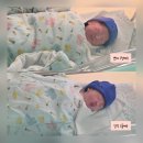 [출산] 일산차병원 제왕절개/쌍둥이 출산 후기