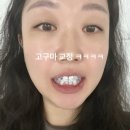 서면예치과 이미지