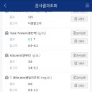 ALK 이미지