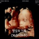 [임신 20주차~24주차] 태교여행, 정밀 초음파 검사,임당검사, 경미한 교통 사고, 태동검사
