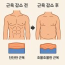 (주)서영헬스앤팜 | 📅 2025년 10월 3일 마운자로 후기 D+39일차, 1달 사용 후기, 진짜 확실하게 심각한 부작용 충격 고백