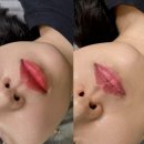 키엘뷰티아카데미 | 입술색 고민끝! 대구 입술반영구 잘하는곳, 키엘뷰티