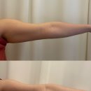 동탄웨딩관리 : 약손명가 동탄나루점 웨딩 라인 관리