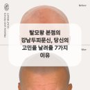 탈모왕 본점 이미지