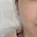 송파피부관리 에스테틱 보라다움 수분 가득 수분관리 후기