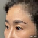 블랙브로우