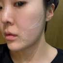 상주중학교 | 신부관리 부산울쎄라 후기 통증, 붓기, 윤곽개선, 이중턱개선 효과
