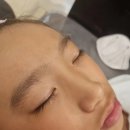 아이메디케어 이미지