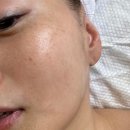 아벨귀금속 | [은블리 추천] 안산 - 피부 1:1 맞춤 특수관리 '보라뷰띠끄' 금손 원장님 픽!
