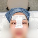 (주)리뉴메디칼 | 부산신부관리 피부관리 잘하는 이브뷰티센터 후기