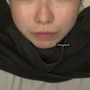 역전할머니맥주(상주무양점) | 은평구여드름전문 구파발피부관리 솔에스테틱 은평직영점 수분케어후기 가격 주차정보