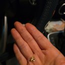 우정치과의원 | 😭 금니가 마이쥬 속으로?! 선연합치과에서 완벽 치료받은 후기