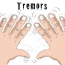 수전증[essential tremor] 이미지