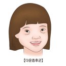 ##.알츠하이머 병 이미지