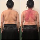 셀몽 | [부산 서면] 서면웨딩관리 추천/ 카리언뷰티클리닉 서면본점 셀몽 등 관리 후기