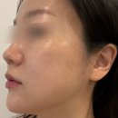 하로스파 | 임산부 수유역 피부관리 하로스파 에서 탄력보습관리 추천 후기