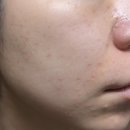 미미스킨케어 | 아비브 어성초 세럼 올리브영 사춘기트러블 중학생스킨케어, 트러블세럼 추천 솔직 후기