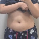 분당-9 | 분당 지방분해주사후기 9주차 변화 직접 확인, 복부 전후 비교