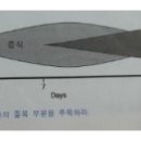 치유의 3단계 - 염증, 증식, 재형성 단계 이미지