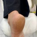 레푸스&아트포레 이미지