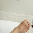 무지외반증 수술 후 부주상골 통증 보유자 닥터포디 깔창 구입 후기 청주 무지외반증수술 윈윈정형외과