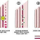 만성 통증 이미지