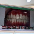 석촌호수치과의원 네이버블로그
