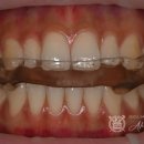 예스치과기공소 이미지