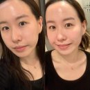 청량리피부관리 약손명가 청량리점 웨딩관리 양악관리 솔직후기