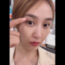 230721 옥 인스타업(prp치료 재생치료듕)+진댓글 이미지