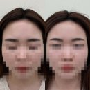 조이컨설팅 - 천안시 동남구 청수5로 3 | 조이로운 군자눈썹 건대눈썹 리터치 솔직후기 눈썹컨설팅 통증 주차안내