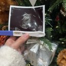 얼리 필라테스 | 자궁근종 복강경 수술 재발 후 자연임신 후기 : 아기집 확인|슈얼리임테기 정확도