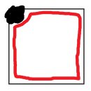 네모치과병원 | 청주 분평동 참조은치과병원 크라운 인레이 치료 내돈내산 리얼 후기 3탄