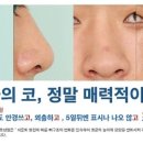 오투성형외과 이미지