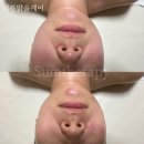 울산 동구 피부관리 잘하는곳 숨테라피 내돈내산 피부맑음케어후기 미백관리 추천