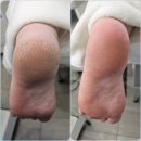 이천문제성발전문#라파엘 이미지