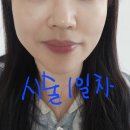 미래스킨케어 | 청담동 피부과 통증 없는 스킨부스터 시너젯 케어 후기, 예민피부 속건조 잡는 모공축소 비결