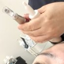 구미피부관리 유에스테틱 유산균테라피 후기