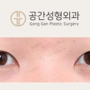 인아웃 이미지