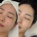 인천 피부관리 에메트에스테틱 1:1 프라이빗 관리 재방문