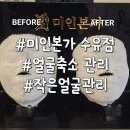 미인개 | 수유역 얼굴축소 관리 후기 미인본가 수유점 작은얼굴관리 솔직 후기