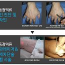 멍클린 이미지