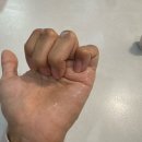 [공지] 매스틱 추출성분 화장품으로 여름 기미관리 시작 :: 매스티나 화이트매스틱 코어앰플